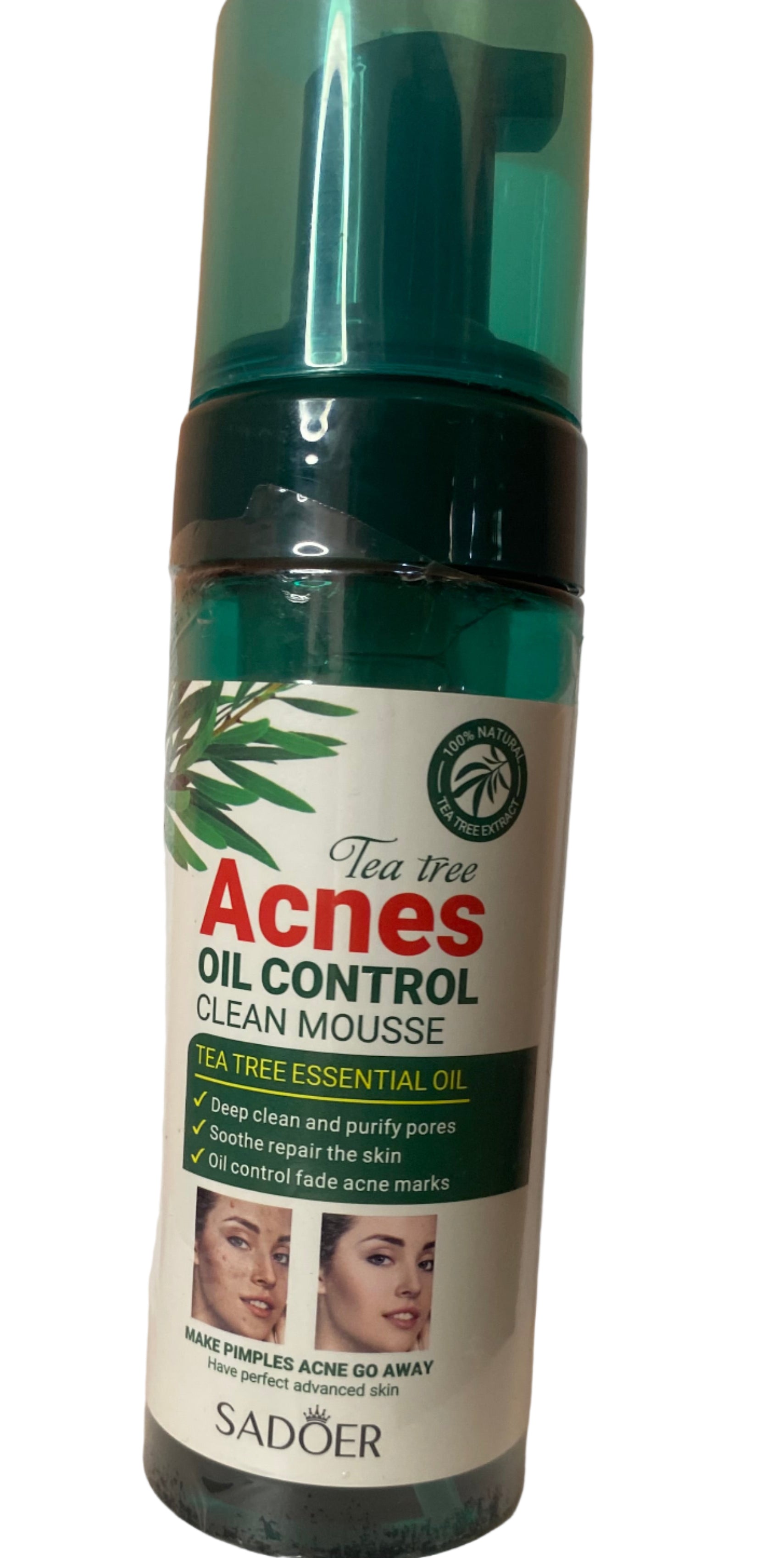 Acne Face Wash balance oily skin