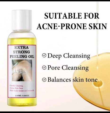 peeling oil” blends exfoliating acids or enzymes with nourishing oils — so it helps remove dead skin, smooth texture, and even out tone, while still keeping the skin hydrated.  ￼