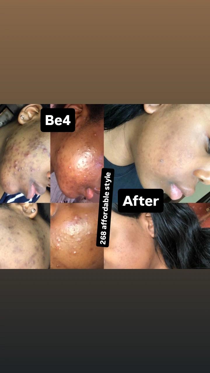 Kojic Spots Cream — Fade Dark Spots & Even Skin Tone

Target stubborn dark spots and uneven skin with our Kojic Spots Cream, formulated to brighten and restore a clear, radiant complexion. Its gentle yet effective formula helps reduce the appearance